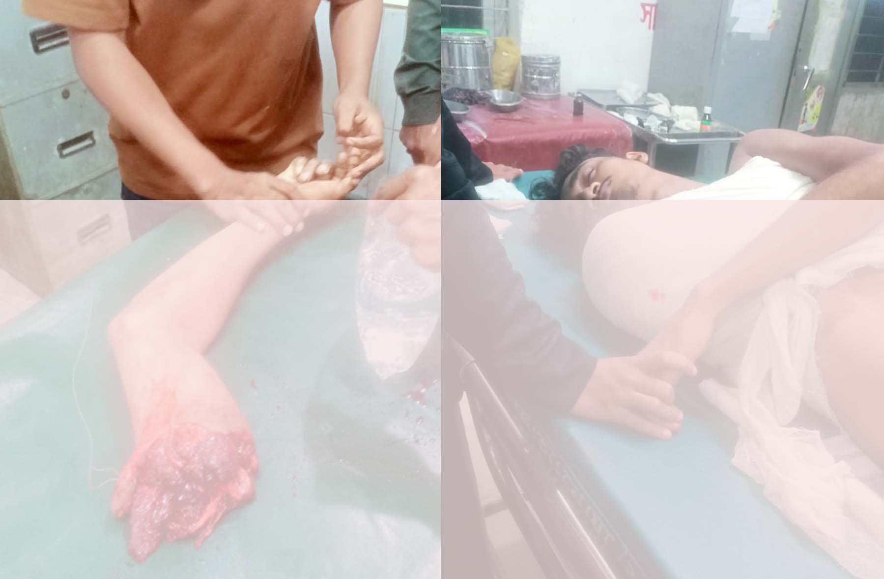 সোনাইমুড়ীতে বেপরোয়া গতির ট্রাকের ধাক্কায় যুবকের হাত বিচ্ছিন্ন