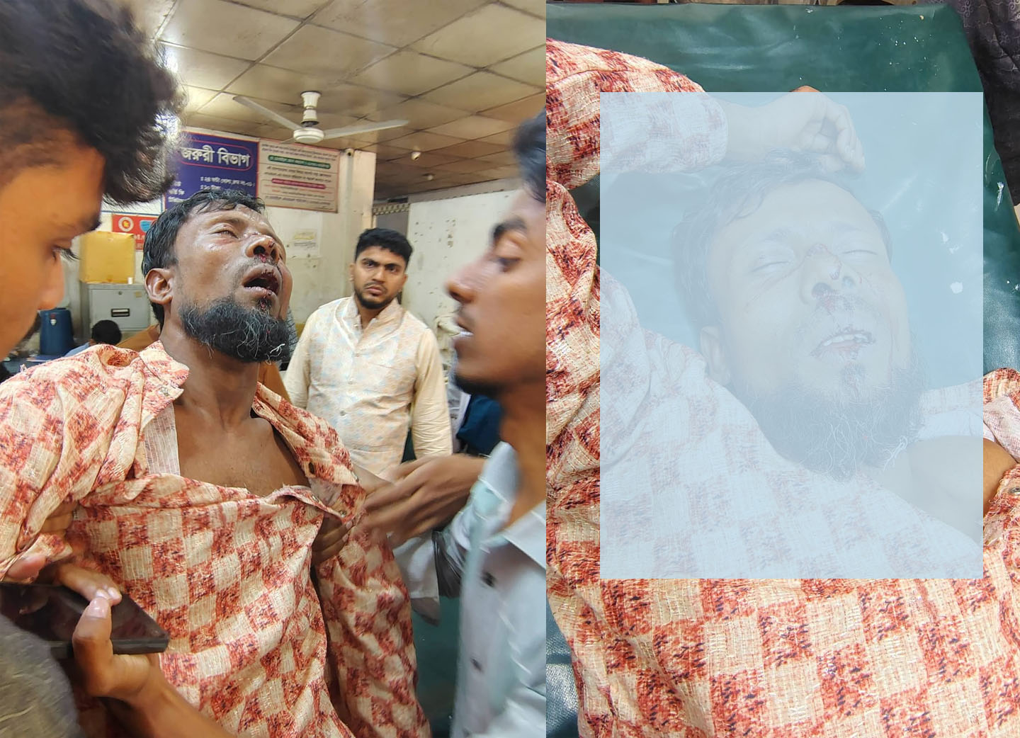 হাদির জন্য দোয়া করায় হট্টগোল-মারধর, শ্রমিক নেতা আহত